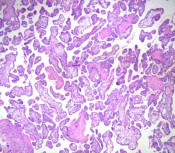 Vellosidades del tejido de la placenta