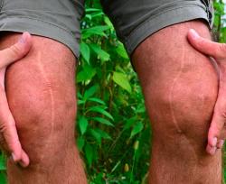 cirugía ortoplástica