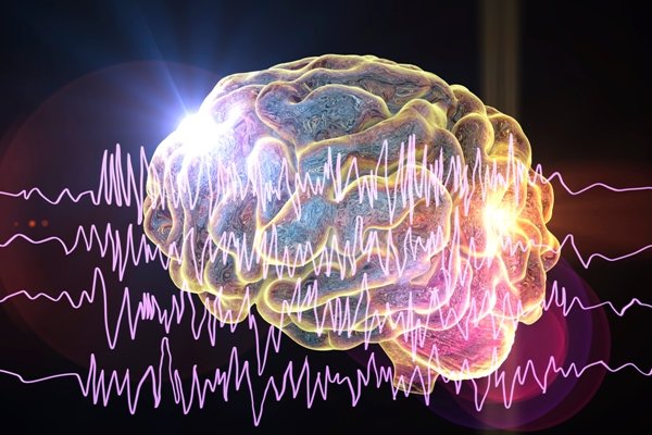 Concepto de epilepsia