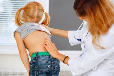 Deteccion de la escoliosis en niños