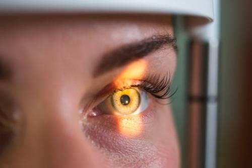 Examen ocular