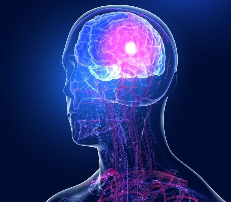 ¿Qué es un ictus isquémico? Síntomas, causas y tratamientos