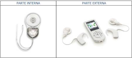 Dispositivo para el implante coclear