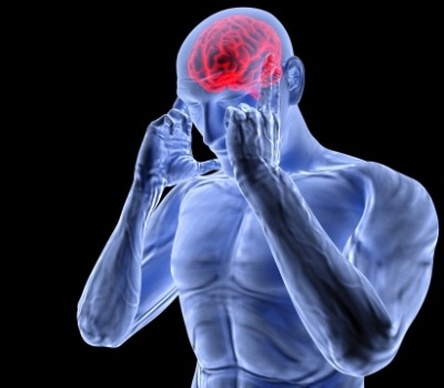 La migraña a través de la resonancia magnética