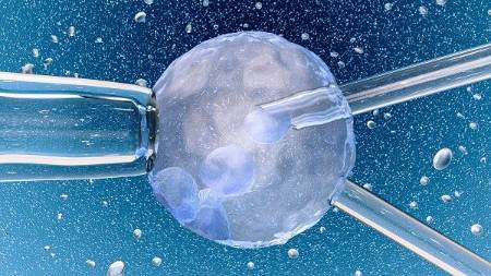 Fecundación in vitro
