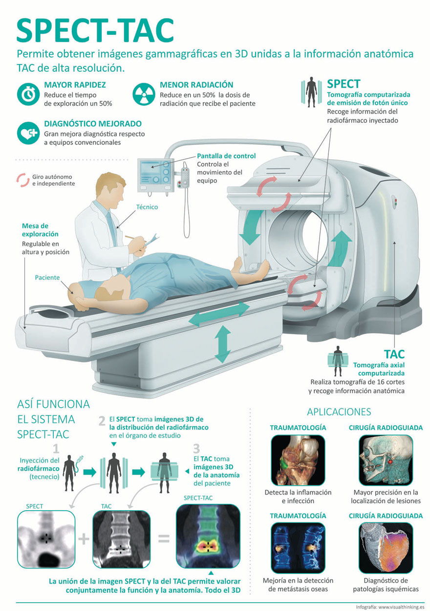 Infografía del SPECT-TAC