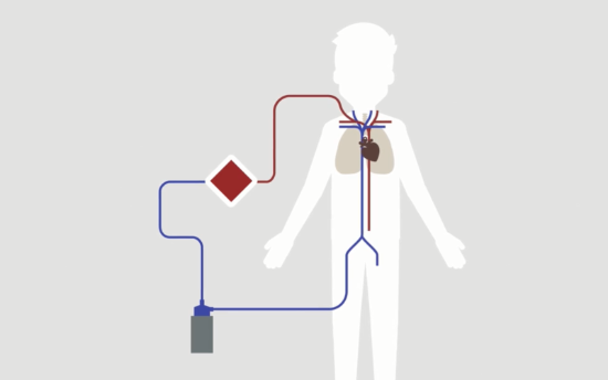 Circuito del equipo ECMO