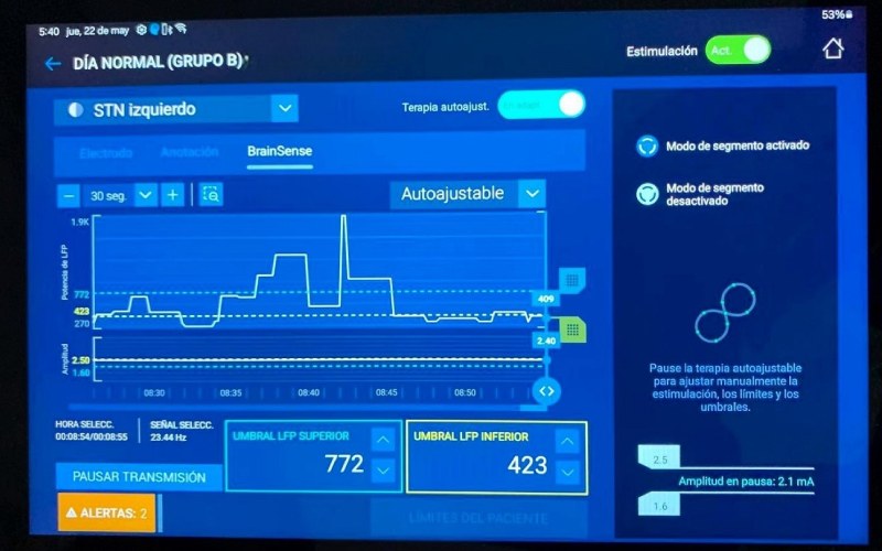 Registro estimulación electrodos
