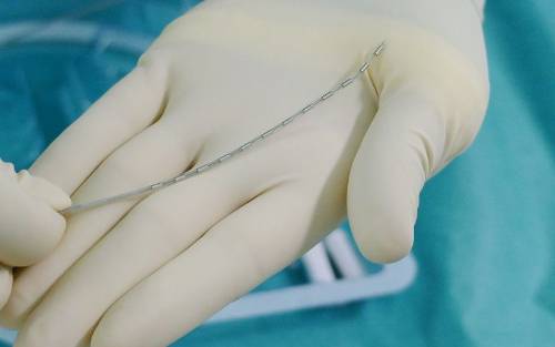 Electrodos que se implantan en la columna vertebral del enfermo