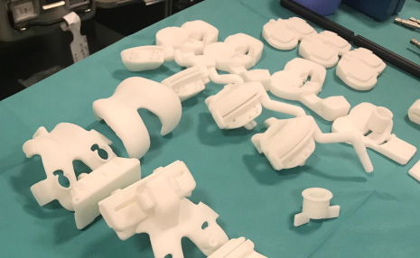 Prótesis 3D de rodilla personalizadas