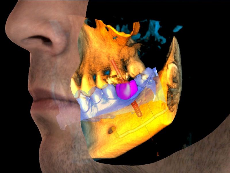 escaner-dental-3d