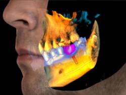 escaner-dental-3d