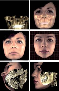 previsualizar-resultado-operacion-escaner-dental-3d