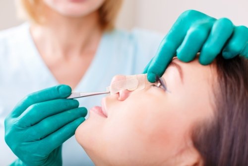 Cirugía de rinoplastia