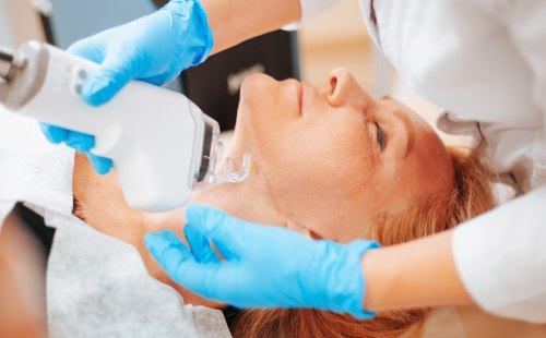 Láser para el rostro: el efecto glow que tu piel necesita