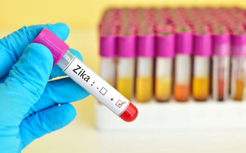 Virus zika